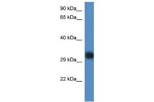 WB Suggested Anti-Gm527 Antibody Titration: 1. (GM527 anticorps  (C-Term))