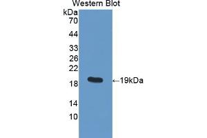 Detection of Recombinant PDIA5, Human using Polyclonal Antibody to Protein Disulfide Isomerase A5 (PDIA5) (PDIA5 anticorps  (AA 378-506))