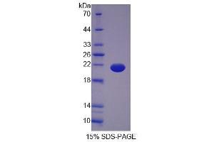 SDS-PAGE analysis of Human OPA3 Protein. (OPA3 Protéine)