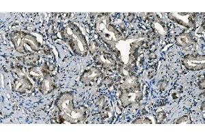 IHC analysis of CDC45L using anti-CDC45L antibody (ABIN7600230). (CDC45 anticorps  (AA 166-431))