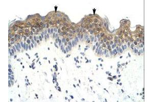 anti-LW-1 (HSFX1) (AA 224-273) antibody