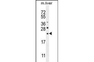 CLEC2L Antibody (N-term) (ABIN654865 and ABIN2844524) western blot analysis in mouse liver tissue lysates (35 μg/lane). (CLEC2L anticorps  (N-Term))