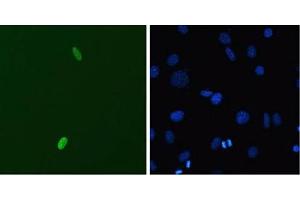 DUX4 Immunofluorescence. (DUX4 anticorps  (C-Term))