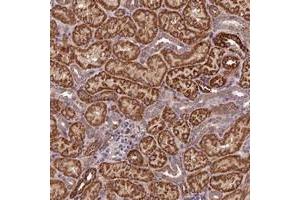Immunohistochemical staining of human kidney with C15orf23 polyclonal antibody  shows strong cytoplasmic positivity in tubular cells at 1:50-1:200 dilution. (KNSTRN anticorps)