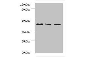 Western blot All lanes: CHI3L2 antibody at 4 μg/mL Lane 1: Hela whole cell lysate Lane 2: Rat brain tissue Lane 3: A431 whole cell lysate Secondary Goat polyclonal to rabbit IgG at 1/10000 dilution Predicted band size: 44, 35, 43 kDa Observed band size: 44 kDa (CHI3L2 anticorps  (AA 27-390))