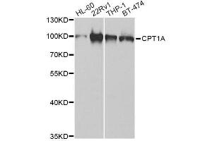 Western blot analysis of extracts of various cell lines, using CPT1A Antibody. (CPT1A anticorps  (AA 497-756))