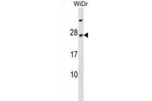 Western Blotting (WB) image for anti-TGFB-Induced Factor Homeobox 2-Like, Y-Linked (TGIF2LY) antibody (ABIN3000164) (TGIF2LY anticorps)