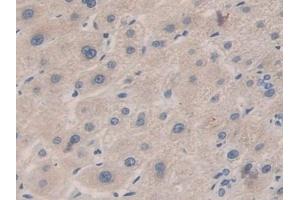 Detection of CPB1 in Human Liver Tissue using Polyclonal Antibody to Carboxypeptidase B1, Tissue (CPB1) (CPB1 anticorps  (AA 111-417))