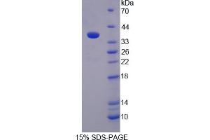 Image no. 1 for Monoamine Oxidase B (MAOB) (AA 206-505) protein (His tag) (ABIN6238457) (Monoamine Oxidase B Protein (MAOB) (AA 206-505) (His tag))