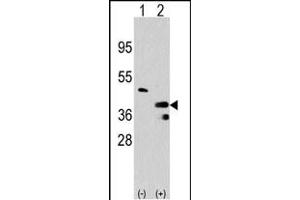 Western blot analysis of PRMT1 (arrow) using rabbit polyclonal PRMT1 Antibody (C-term) (R). (PRMT1 anticorps  (C-Term))