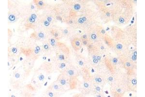 DAB staining on IHC-P; Samples: Human Liver Tissue (COL18 anticorps  (AA 1572-1754))