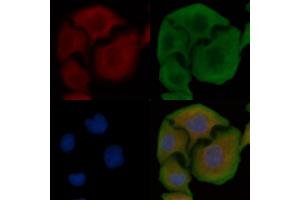 ABIN6258096 and ABIN6274395 staining Hela cells by IF/ICC. (RBM26 anticorps  (Internal Region))