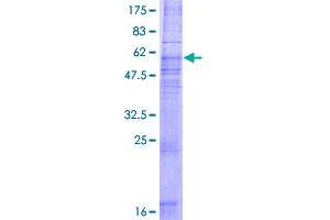 Image no. 1 for Chemokine (C-C Motif) Receptor 8 (CCR8) (AA 1-355) protein (GST tag) (ABIN1348500)