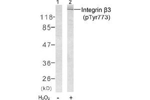 Image no. 2 for anti-Integrin beta 3 (ITGB3) (pTyr773) antibody (ABIN196721) (Integrin beta 3 anticorps  (pTyr773))