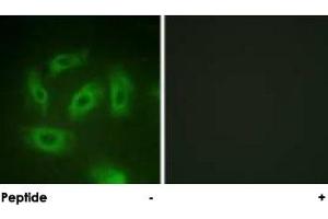 Immunofluorescence analysis of HeLa cells, using TGFBR1 polyclonal antibody . (TGFBR1 anticorps  (Ser165))