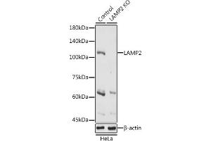 Western blot analysis of extracts of HeLa cells, using L antibody (ABIN6129969, ABIN6143081, ABIN6143082 and ABIN6218224) at 1:1000 dilution. (LAMP2 anticorps  (AA 30-300))