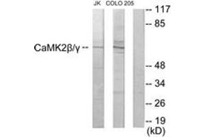 Western blot analysis of extracts from COLO205/Jurkat cells, using CaMK2 beta/gamma Antibody. (CaMK2 beta/gamma anticorps  (AA 509-558))