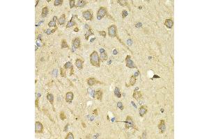 Immunohistochemistry of paraffin-embedded rat brain using IL10RA antibody at dilution of 1:200 (400x lens). (IL-10RA anticorps)