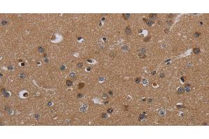 Immunohistochemistry of paraffin-embedded Human brain tissue using PDGFC Polyclonal Antibody at dilution 1:40 (PDGFC anticorps)