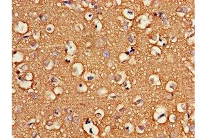 Immunohistochemistry of paraffin-embedded human brain tissue using ABIN7175266 at dilution of 1:100