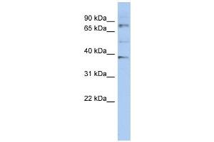 OAS2 antibody used at 1 ug/ml to detect target protein. (OAS2 anticorps  (N-Term))