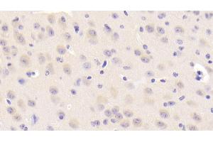 Detection of NEIL3 in Mouse Cerebrum Tissue using Polyclonal Antibody to Nei Endonuclease VIII Like Protein 3 (NEIL3)