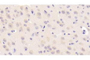 Detection of NEIL3 in Mouse Cerebrum Tissue using Polyclonal Antibody to Nei Endonuclease VIII Like Protein 3 (NEIL3) (NEIL3 anticorps  (AA 2-187))