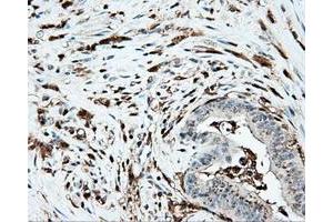 Immunohistochemical staining of paraffin-embedded Kidney tissue using anti-PLEK mouse monoclonal antibody. (Pleckstrin anticorps)