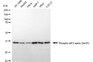 Western blotting analysis using phospho-eIF2 alpha (Ser51) antibody (ABIN7798512). (Recombinant EIF2A anticorps  (pSer51))