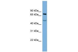 WB Suggested Anti-STIM1 Antibody Titration:  0. (STIM1 anticorps  (Middle Region))