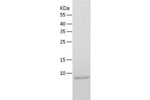 Western Blotting (WB) image for Limb-Bud and Heart (LBH) (AA 1-105) protein (His-IF2DI Tag) (ABIN7123765)