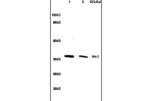 Lane 1: mouse liver lysates Lane 2: mouse intestine lysates probed with Anti HSD17B1/HSD17 Polyclonal Antibody, Unconjugated (ABIN718706) at 1:200 in 4 °C. (HSD17B1 anticorps  (AA 21-120))