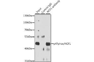 Immunoprecipitation analysis of 200 μg extracts of Raji cells, using 3 μg p47phox/NCF1 antibody (ABIN3021550, ABIN3021551, ABIN3021552 and ABIN6215231). (NCF1 anticorps  (AA 1-390))