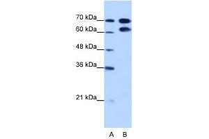 RAVER1 antibody used at 1. (RAVER1 anticorps  (N-Term))