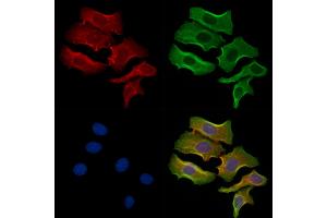 ABIN6261419 and ABIN6278340 staining Hela cells by IF/ICC. (EBI3 anticorps  (N-Term))