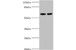 Western blot All lanes: N-acetylserotonin O-methyltransferase-like protein antibody at 2 μg/mL Lane 1: Hela whole cell lysate Lane 2: A549 whole cell lysate Secondary Goat polyclonal to rabbit IgG at 1/10000 dilution Predicted band size: 69, 68, 63 kDa Observed band size: 69 kDa (ASMTL anticorps  (AA 1-290))
