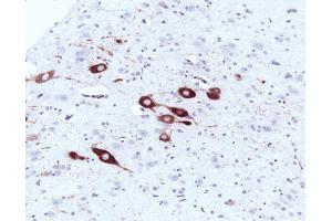 Immunohistochemical staining of a formalin-fixed paraffin-embedded rat brain tissue section with no pre-treatment (20X magnification). (NOS1 anticorps  (AA 1095-1289))