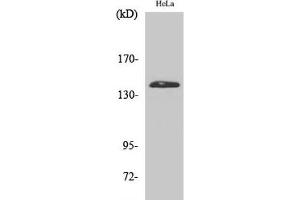 Western Blot analysis of Hela cells using PERK Polyclonal Antibody at dilution of 1:2000. (PERK anticorps)