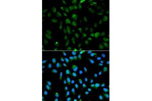 Immunofluorescence analysis of MCF-7 cells using PSMA3 antibody.