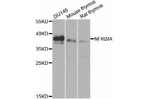 Western blot analysis of extracts of various cell lines, using NFKBIA antibody.