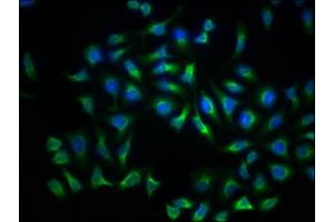 Immunofluorescence staining of Hela Cells with ABIN7127599 at 1:50, counter-stained with DAPI.
