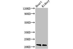 Western Blot Positive WB detected in: Mouse heart tissue, Mouse kidney tissue All lanes: SDC4 antibody at 3 μg/mL Secondary Goat polyclonal to rabbit IgG at 1/50000 dilution Predicted band size: 22, 17 kDa Observed band size: 22 kDa (SDC4 anticorps  (AA 19-145))