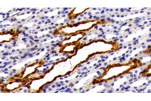 Detection of GAL3 in Rat Kidney Tissue using Polyclonal Antibody to Galectin 3 (GAL3)