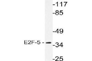 Western blot analysis of E2F5 Antibody in extracts from HeLa cells. (E2F5 anticorps)