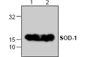 Image no. 1 for anti-Superoxide Dismutase 1, Soluble (SOD1) antibody (ABIN127136)