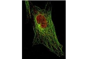 Immunofluorescence (IF) image for anti-Signal Transducer and Activator of Transcription 5A (STAT5A) (Tyr694) antibody (ABIN400812) (STAT5A anticorps  (Tyr694))