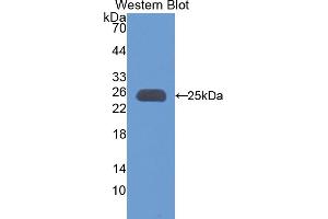 Western blot analysis of the recombinant protein. (Apolipoprotein M anticorps  (AA 20-190))