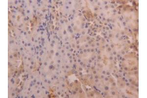 DAB staining on IHC-P; Samples: Rat Kidney Tissue (SERPINA6 anticorps  (AA 173-344))