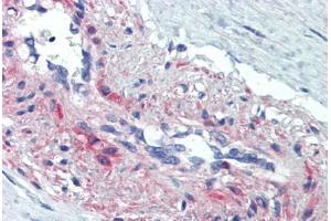 anti-Synovial Sarcoma, X Breakpoint 4 (SSX4) (AA 108-157) antibody