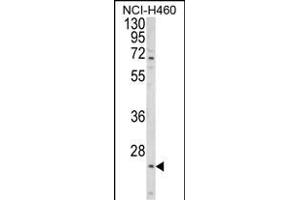 Western blot analysis of ALG14 Antibody (Center) (ABIN652850 and ABIN2842550) in NCI- cell line lysates (35 μg/lane). (ALG14 anticorps  (AA 67-93))